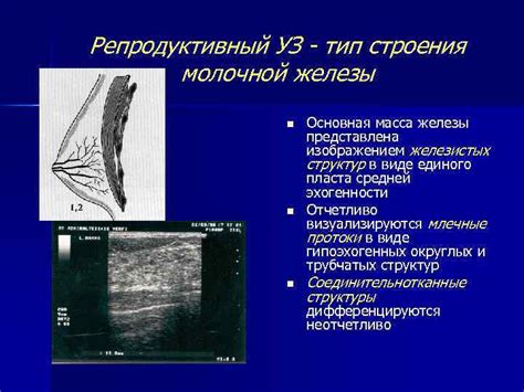 Репродуктивный тип молочной железы