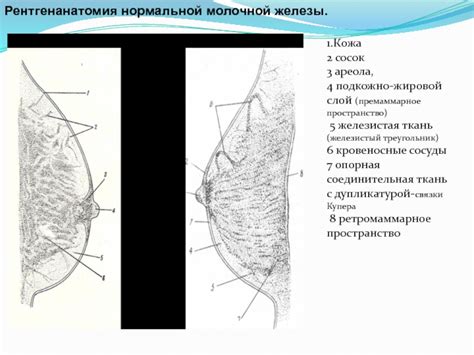 Ретромаммарное пространство молочной железы свободно