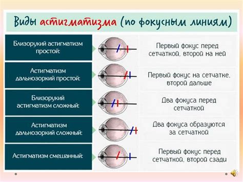 Рефракция и ее значение для зрения