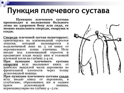 Риски и осложнения при процедуре