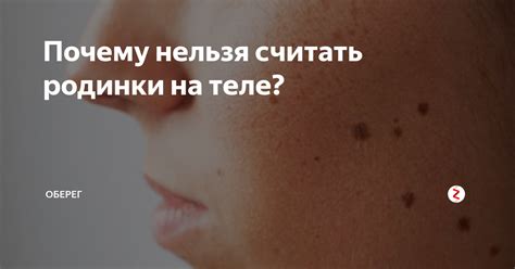 Родинки на теле: почему они важны?