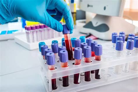 Роль анализов крови в диагностике здоровья