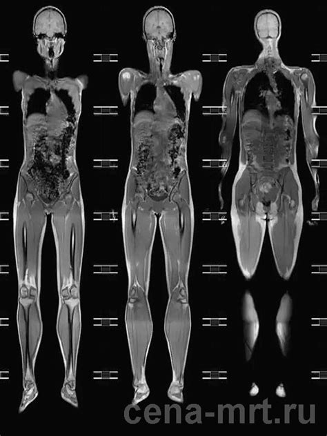 Роль и принципы PET/CT при исследованиях всего организма