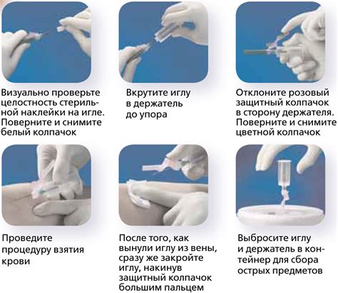 Роль локтевой вены при взятии крови для анализа