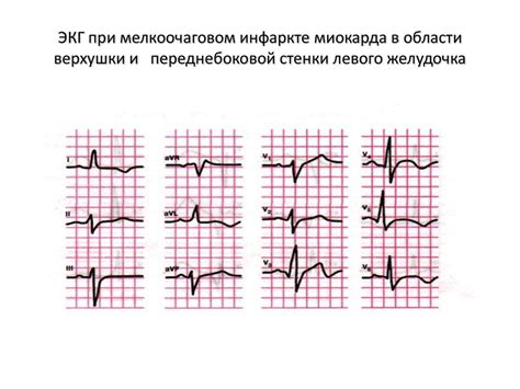 Роль миокарда в сердечной системе