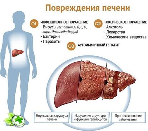 Роль накопления ФДГ в печени при заболеваниях