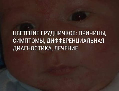 Роль питания и цветения у новорожденных