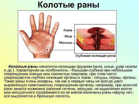 Связь метафорического значение снов о нанесении раны ножом на руку и реальными ситуациями в жизни