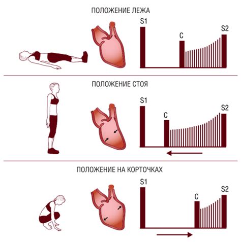 Связь систолического шума с сердечно-сосудистыми заболеваниями