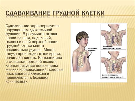 Сдавливание грудной клетки в связи с заболеваниями сердца и легких