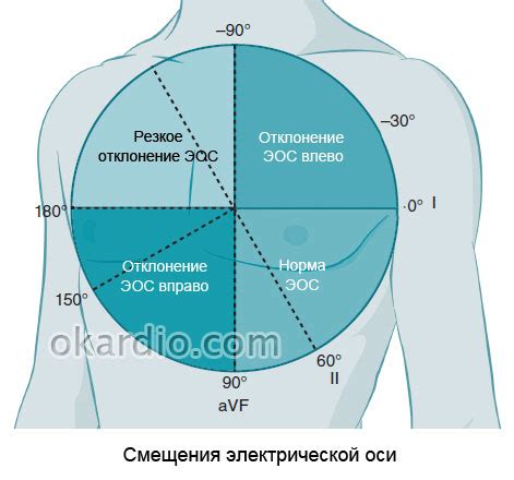 Сдвиг электрической оси сердца влево: причины и значение