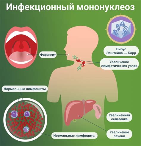 Семь способов устранить боль в горле: советы специалистов