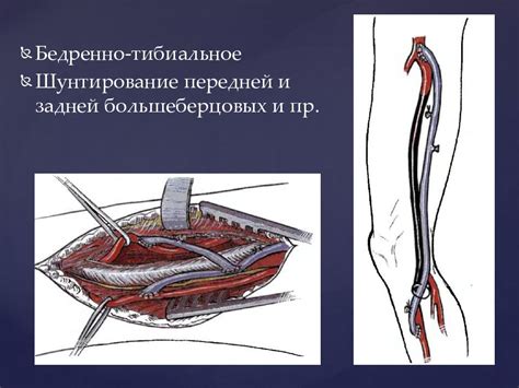 Сигналы о внутренней борьбе: причины появления поражения тканей нижних конечностей