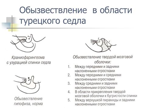 Сидение в турецком седле: особенности и правила