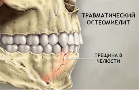 Симптомы, связанные с щелканием челюсти