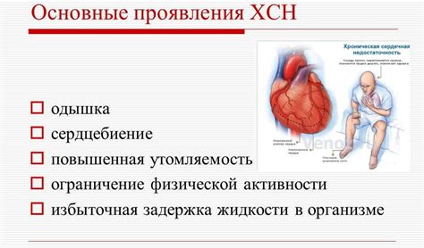 Симптомы СВД кардиологии