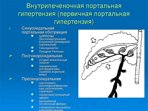 Симптомы гепатомегалии без признаков портальной гипертензии