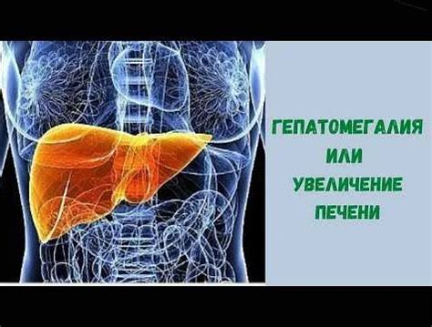 Симптомы гепатомегалии и как ее диагностировать