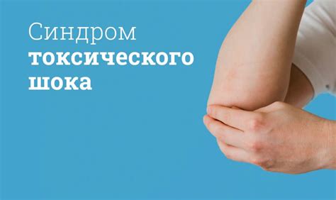 Симптомы гепато-токсического синдрома