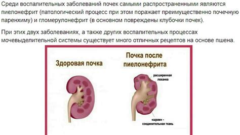 Симптомы и диагностика лоханки почки