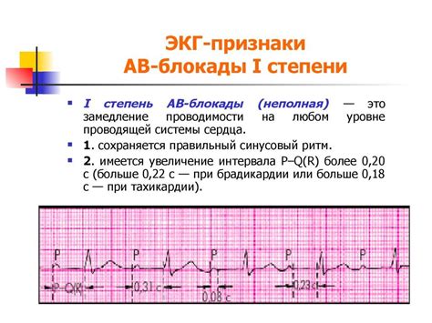 Симптомы и последствия нарушений внутрипредсердной проводимости