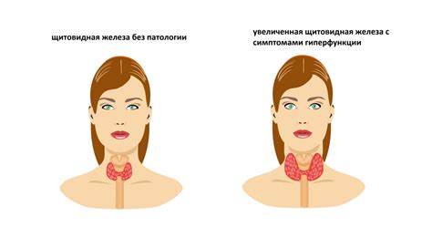 Симптомы и последствия низкого уровня гормона ТТГ у женщин