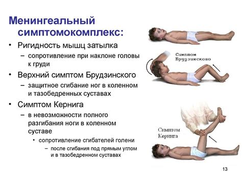 Симптомы и признаки мелковолнистых контуров