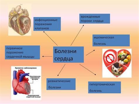 Симптомы и признаки пикового сердца