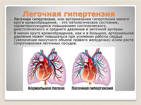 Симптомы и ранние признаки легочной гипертензии