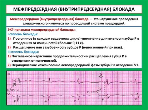 Симптомы нарушения внутрипредсердной проводимости на ЭКГ