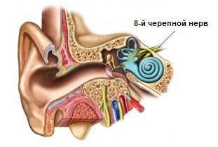 Симптомы невриномы слухового нерва