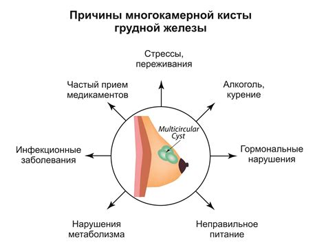 Симптомы неоднородной кисты молочной железы