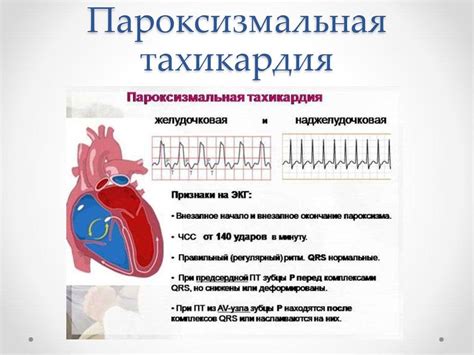 Симптомы неустойчивого пароксизма наджелудочковой тахикардии