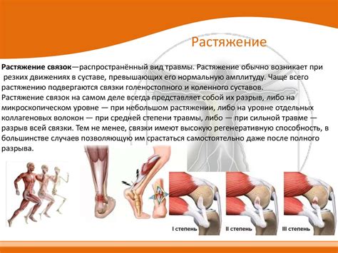 Симптомы обызвествления связок