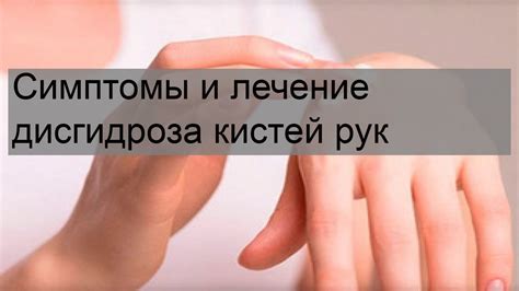 Симптомы опухания кистей рук