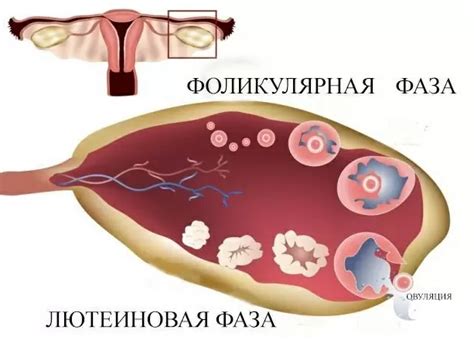 Симптомы повышенной лютеиновой фазы