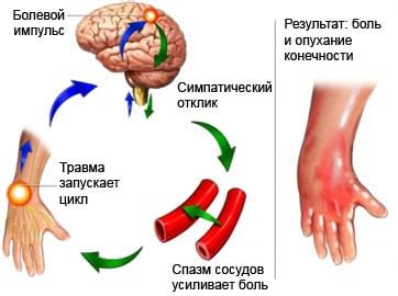 Симптомы стойкого болевого синдрома