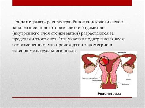 Симптомы толстого слоя эндометрия