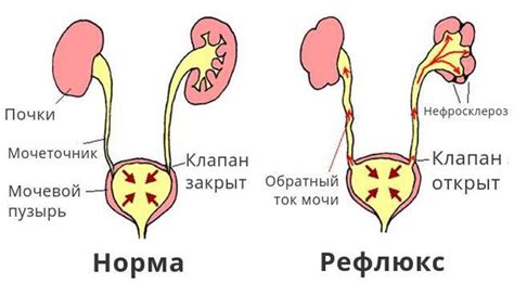 Симптомы уплотнения ЧЛС почек