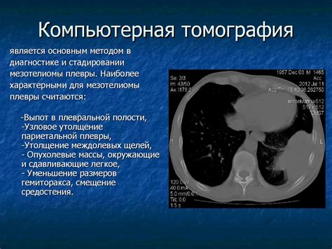 Симптомы уплотнения костальной плевры