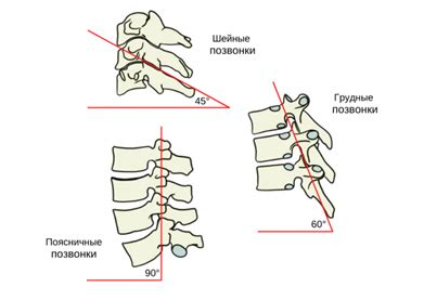 Симптомы фасеточного синдрома