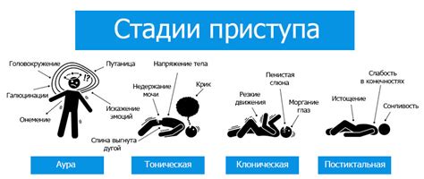 Симптомы фокальной эпилепсии и сопутствующие проявления