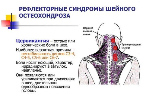 Симптомы цервикокраниалгии