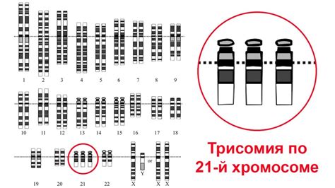 Синдром Дауна на какой неделе