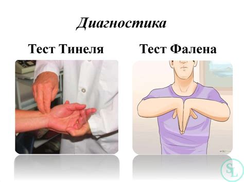 Синдром карпального канала как причина онемения мизинца