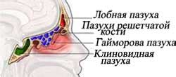 Синусит и жгучая боль в ушах: связь и лечение