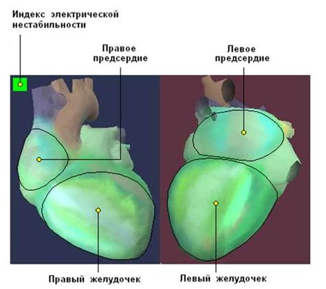 Систематическое стынетие сердца: когда требуется медицинский контроль?