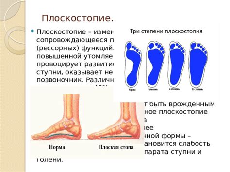 Слабость мышц и костей