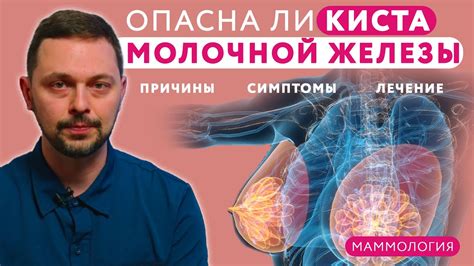 Сложная киста молочной железы: симптомы и методы лечения