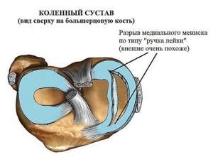 Смысл сновидения, в котором происходит повреждение колена